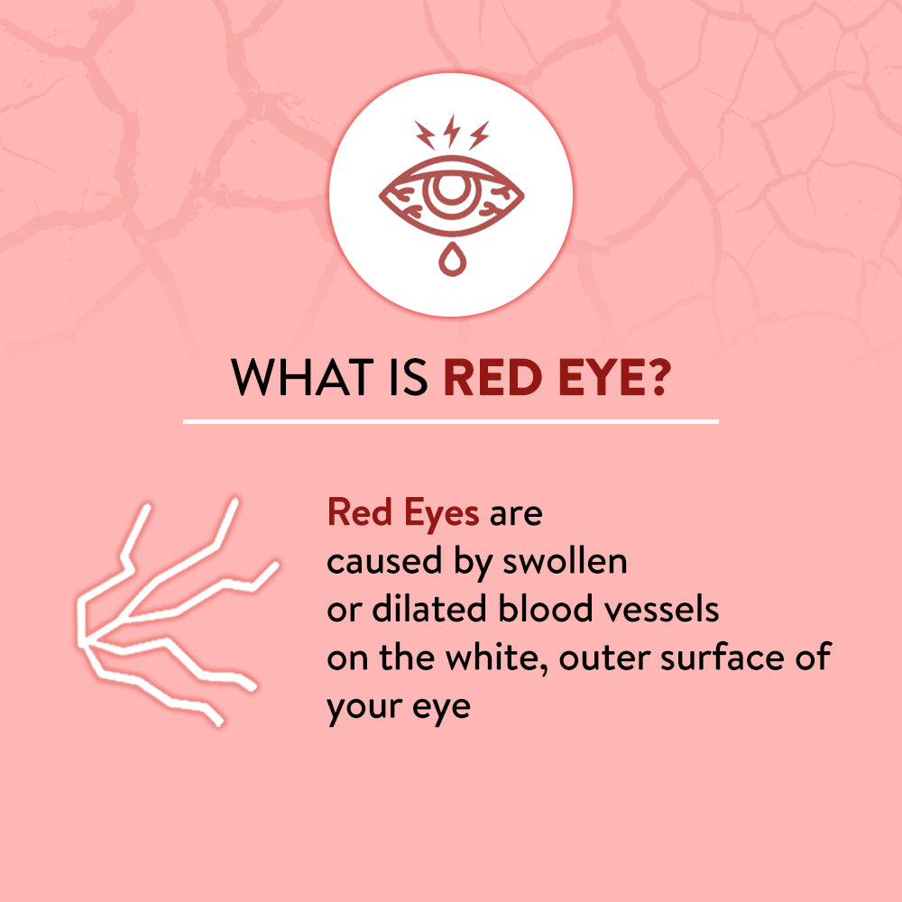 Explanation of red eye on a pink background with an eye icon.