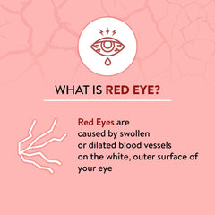Explanation of red eye on a pink background with an eye icon.