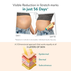 Effective results of regular use of Inostretch Intensive Scar & Stretch Mark Removal Cream in 56 days.