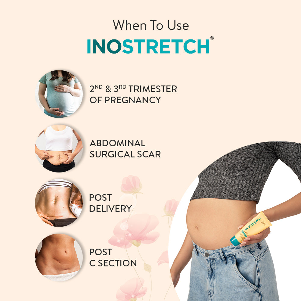 Reasons to choose Inostretch Intensive Scar & Stretch Mark Removal Cream over other creams.