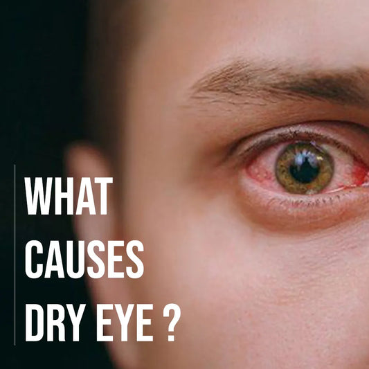 What Causes Dry Eyes? Common Lifestyle Mistakes