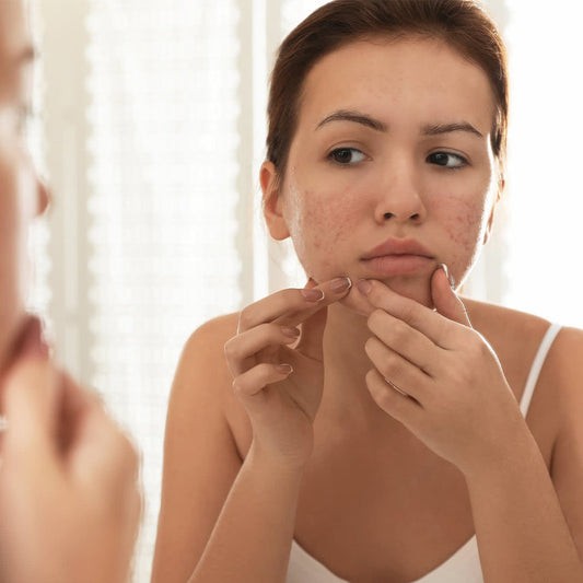 Understand Gut-Skin Axis: Get The Glow From Within