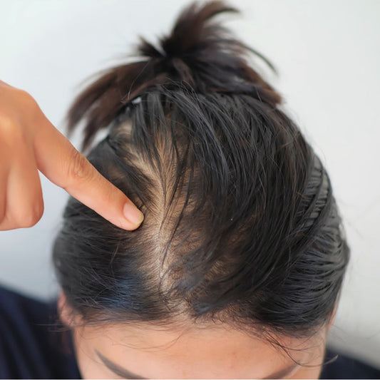 Benefit of Biotin, Selenium and Zinc to Promote Hair Growth