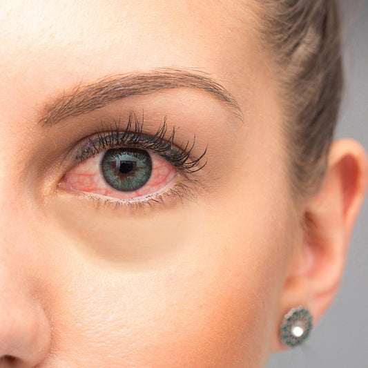 Possible Reasons of Red Eyes