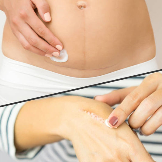 Role of Vitamin E in Skin Care