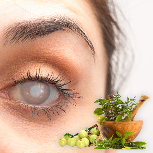 How to Prevent Cataracts: Antioxidant Foods & Herbs for Eye Health