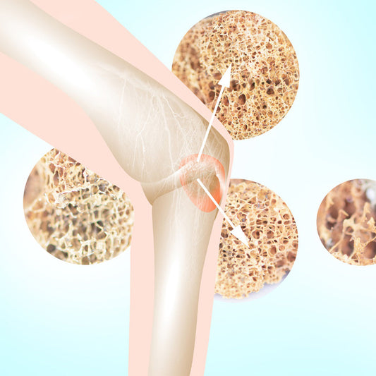Understanding Bone Density and Natural Ways to Strengthen Bones