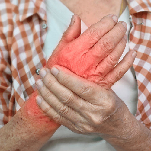 Manage Arthritis Pain At Home