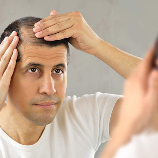 Best Vitamins and Minerals for Men Pattern Balding