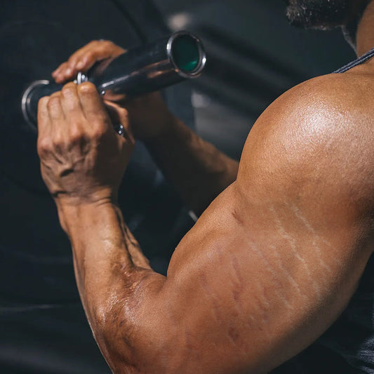 How to Prevent and Fix Stretchmarks Due to Weight Training