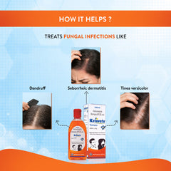Ketovate 2% Anti-Dandruff Shampoo - 100ml