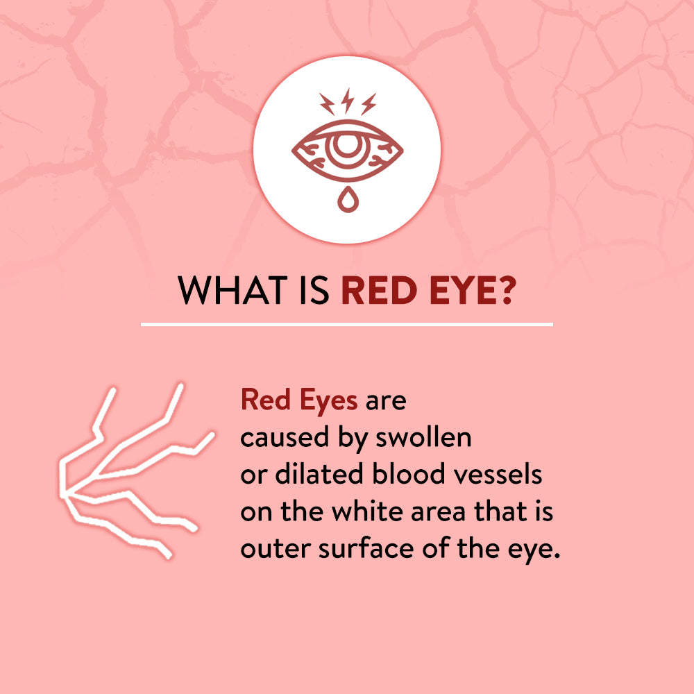 Explanation of red eye on a pink background with an eye icon.
