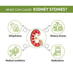 Infographic on what can cause kidney stones with icons and text.